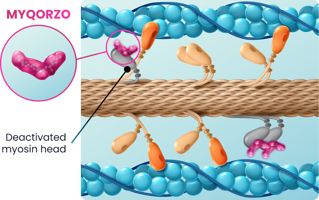 oHCM cardiac sarcomere with MYQORZO