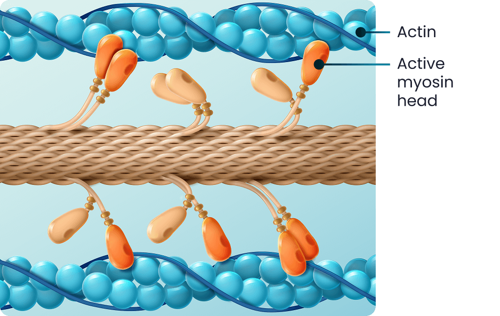 oHCM cardiac sarcomere